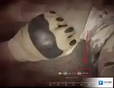 战术小队Squad医疗包